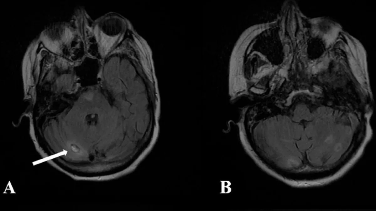 Csak az orrát öblítette ki, belehalt a nő! Durva, hogy miért - Fotók