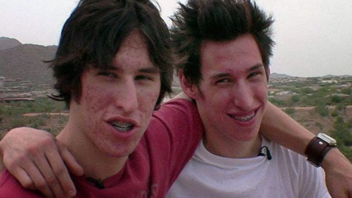 6 milliót költött ez az ikerpár, hogy Brad Pittre hasonlítson! Íme az eredmény!