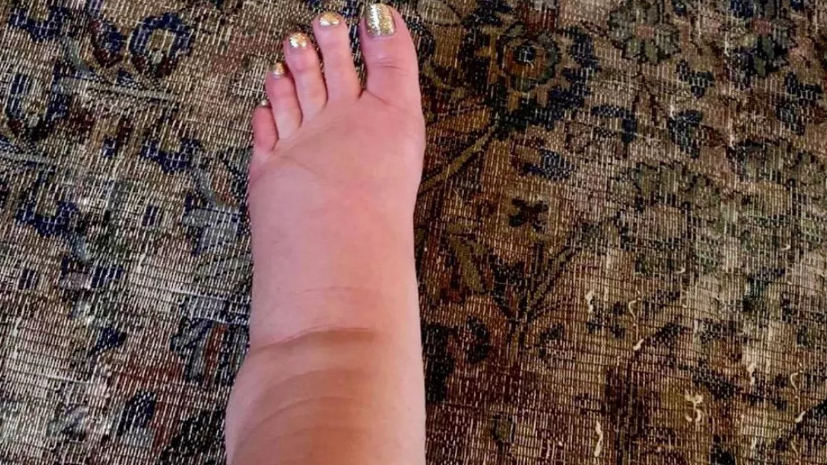 Rajongói segítségét kéri! Így néz ki a szexi énekesnő lába most!