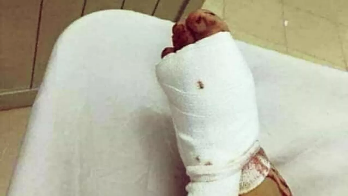 Baseball ütővel verte szét az alvó szerelme lábait a megrémült férfi! Döbbenet, hogy miért!