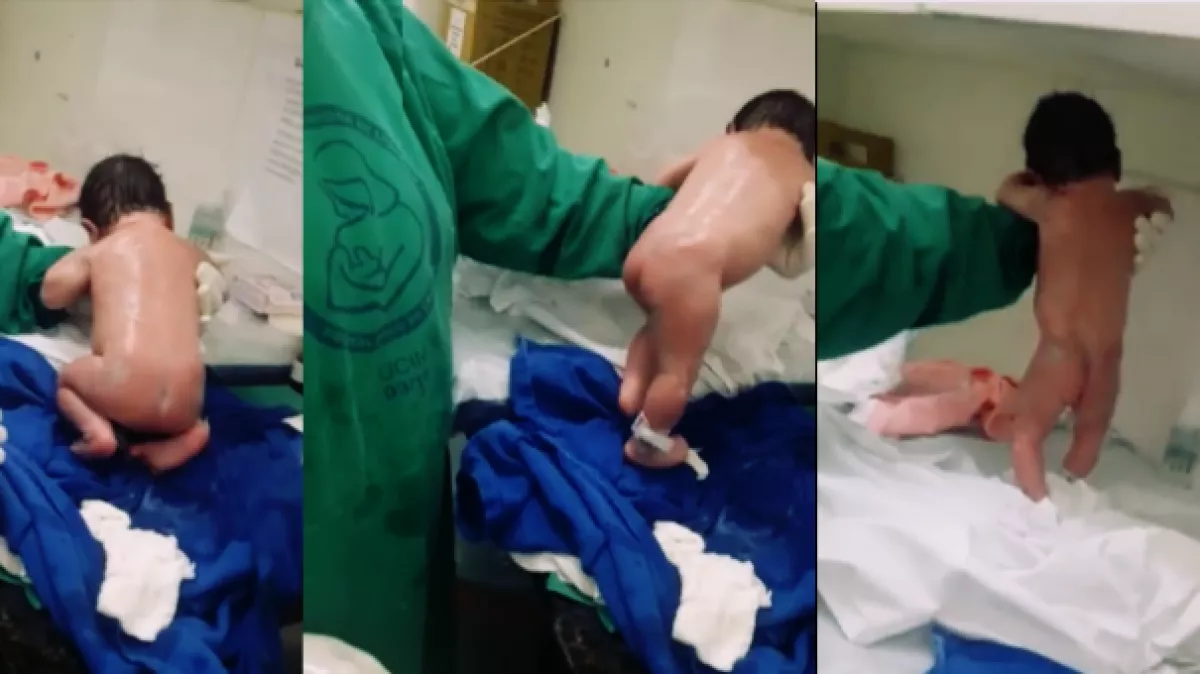 Lábra állt és járni kezdett a születése után egy újszülött - videó
