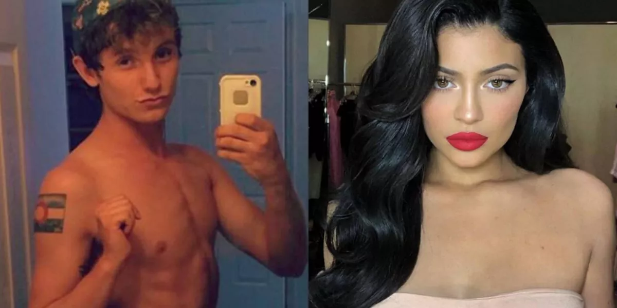 Kylie Jenner-ré műttette magát ez a 24 éves srác! Mutatjuk a végeredményt - Fotók