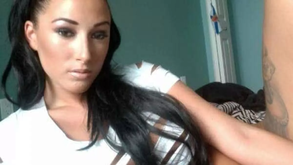 32 milliót költött plasztikai műtétekre ez a táncoslány, sokan undorodnak így tőle! - Fotók