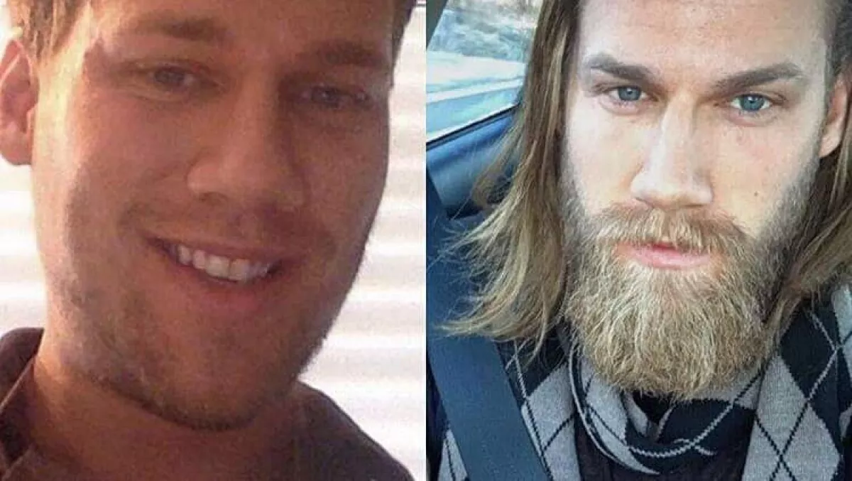 Íme 10 férfi, mint bizonyíték, hogy a szakáll bárkit vonzóvá tud tenni!