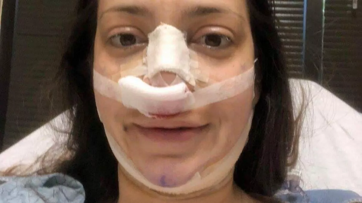 7 milliót költött ez a nő, hogy Meghan Markle-t operáljanak belőle! - Fotók