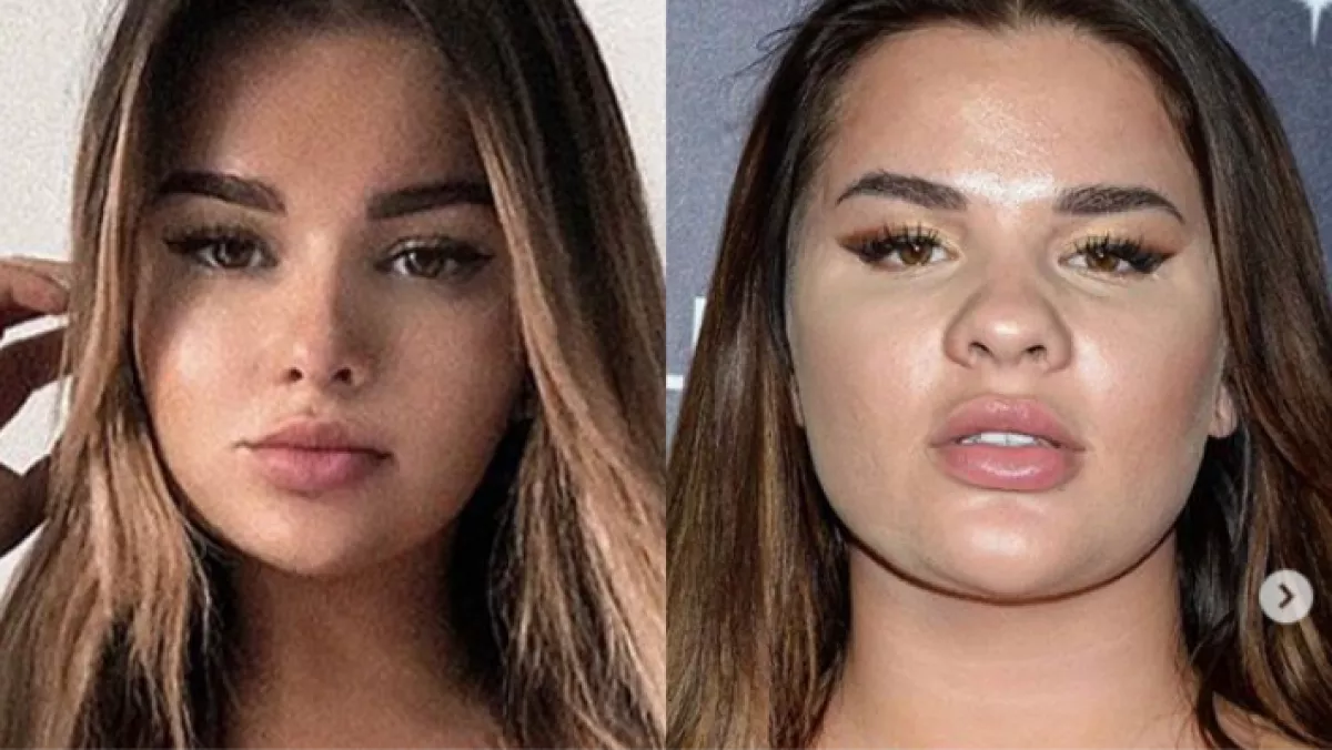 Rettegnek a kamu Insta-modellek! Feltöltik a netre a retus nélküli képeiket!