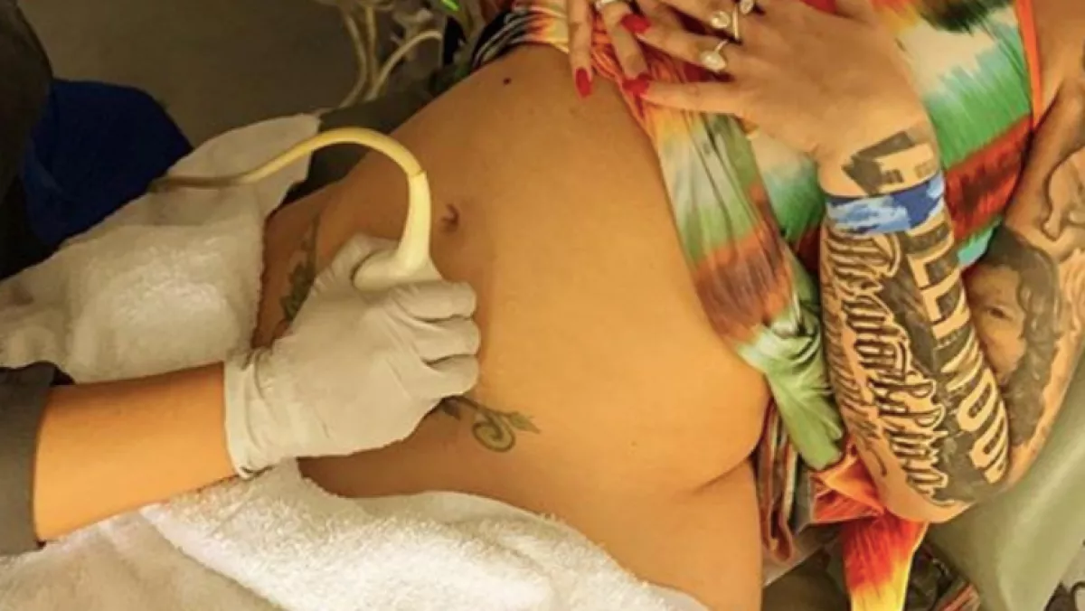 Így jelentette be az Instán: anya lesz a híres bikini-modell!