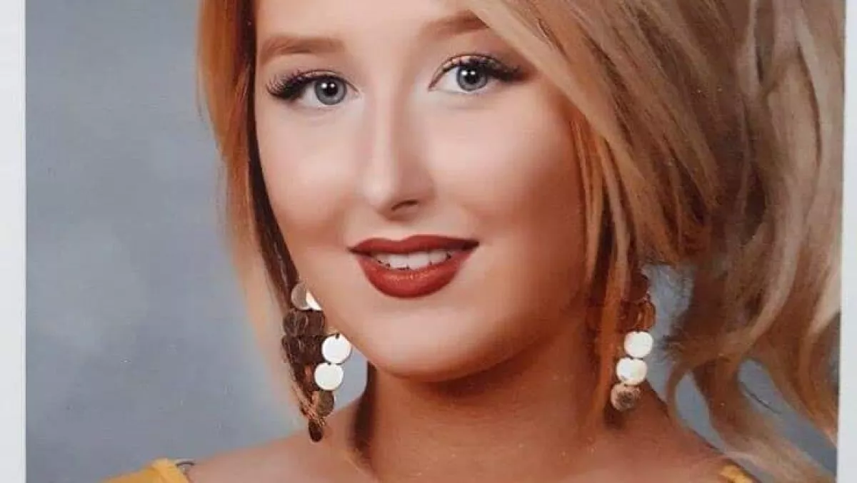 Barbie-vá operáltatta magát Amanda, de inkább egy szörnyre hasonlít - Fotók