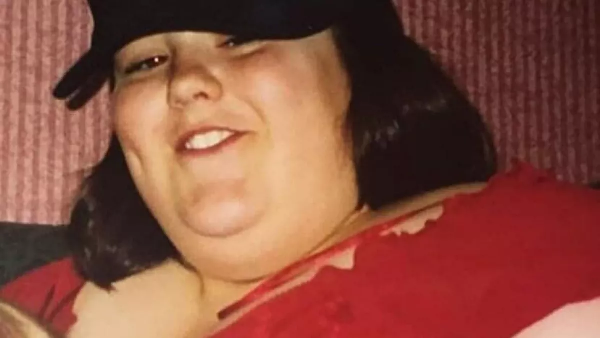 Testsúlya felére fogyott ez a nő, de milliókra van még szüksége, hogy 6 kilótól megszabaduljon - Fotók