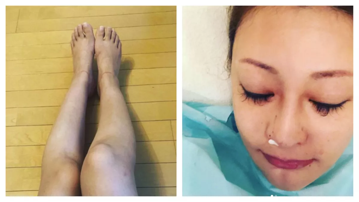 83 milliót költött plasztikai műtétekre ez a nő - így néz ki most! - Fotók