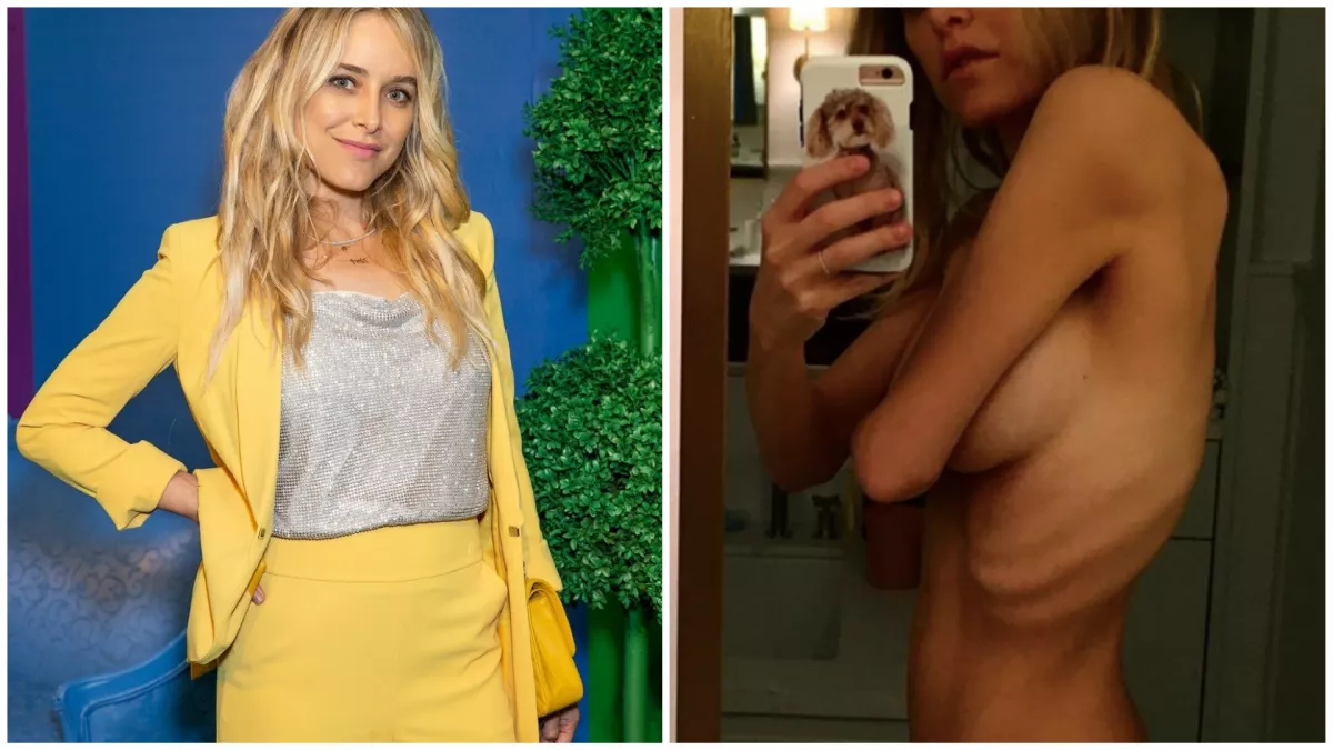 Megállíthatatlanul fogyni kezdett a szülés után a színésznő, a diagnózis sokkoló... - Fotók