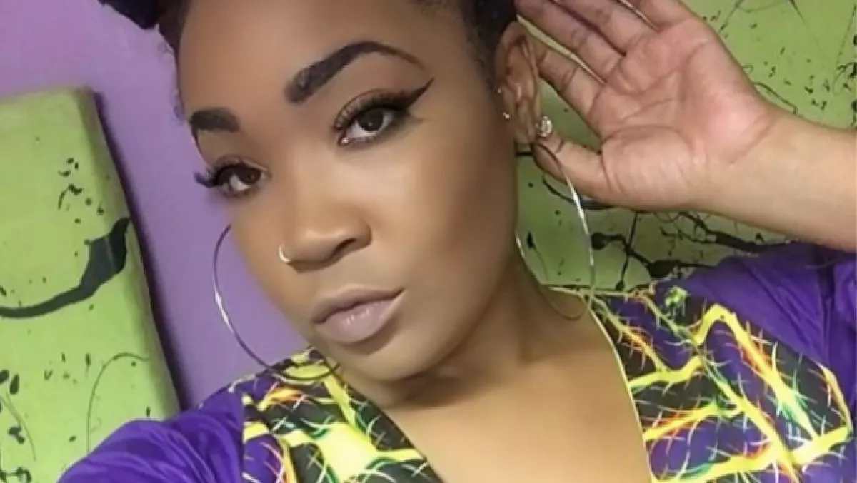 Műpopsija miatt lett pokol az Insta-modell élete, így néz ki most - Fotók