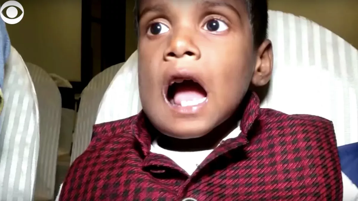 Nagyon fájt az állkapcsa: 526 fogat találtak a kisfiú szájában! - Fotók