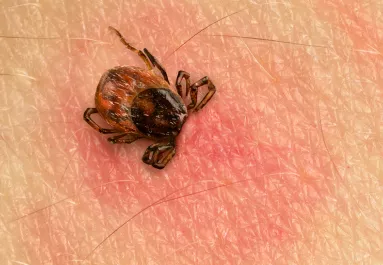 Vigyázat! Ezekben a megyékben van a legtöbb Lyme-kórt terjesztő kullancs