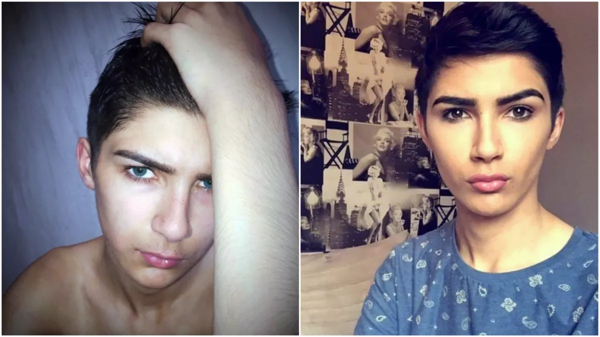 15 évesen lett Kim Kardashian ez a fiú, azóta pedig egészen mássá operáltatta magát - Fotók