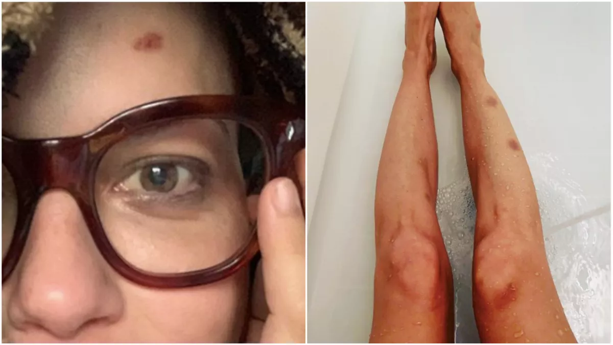 Megrázó képek! Gyógyíthatatlan betegsége felemészti a Dr. Szöszi sztárját- Fotó