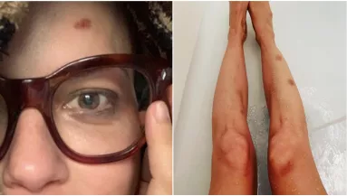 Megrázó képek! Gyógyíthatatlan betegsége felemészti a Dr. Szöszi sztárját- Fotó