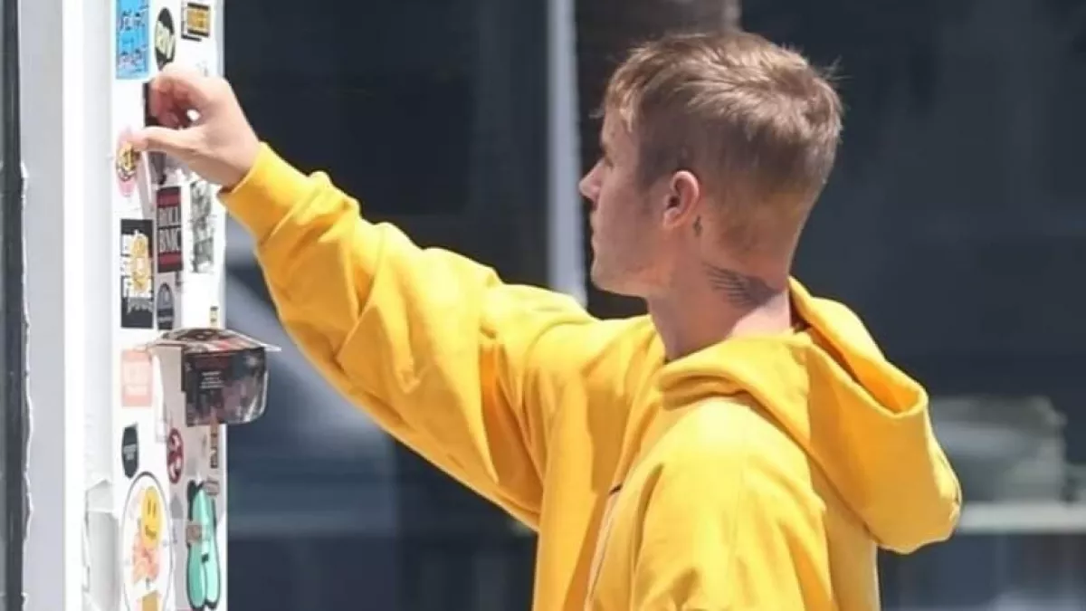 Miért nem csinál vele valamit? Justin Bieber arca gusztustalan - Fotók