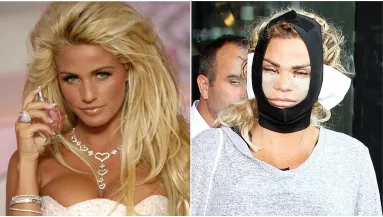 Élő szörnyeteggé plasztikázták az egykori sztármodellt! - Így néz ki most - Fotók 