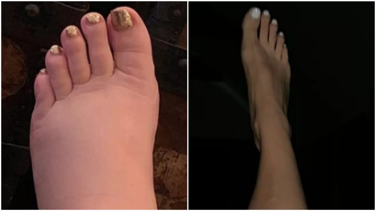 Rá se ismerni: 6 hónap alatt 45 kilót fogyott az énekesnő! - Fotók