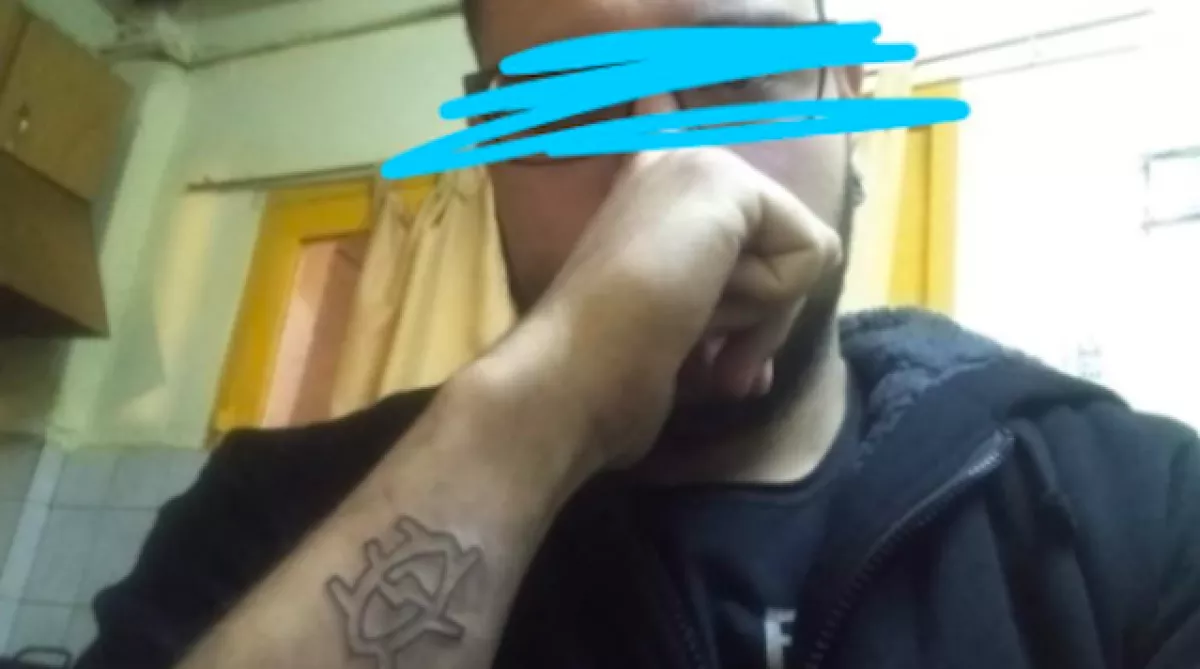 Sajtreszelővel szedte le a tetkóját ez a 21 éves srác. Így sikerült - Fotók