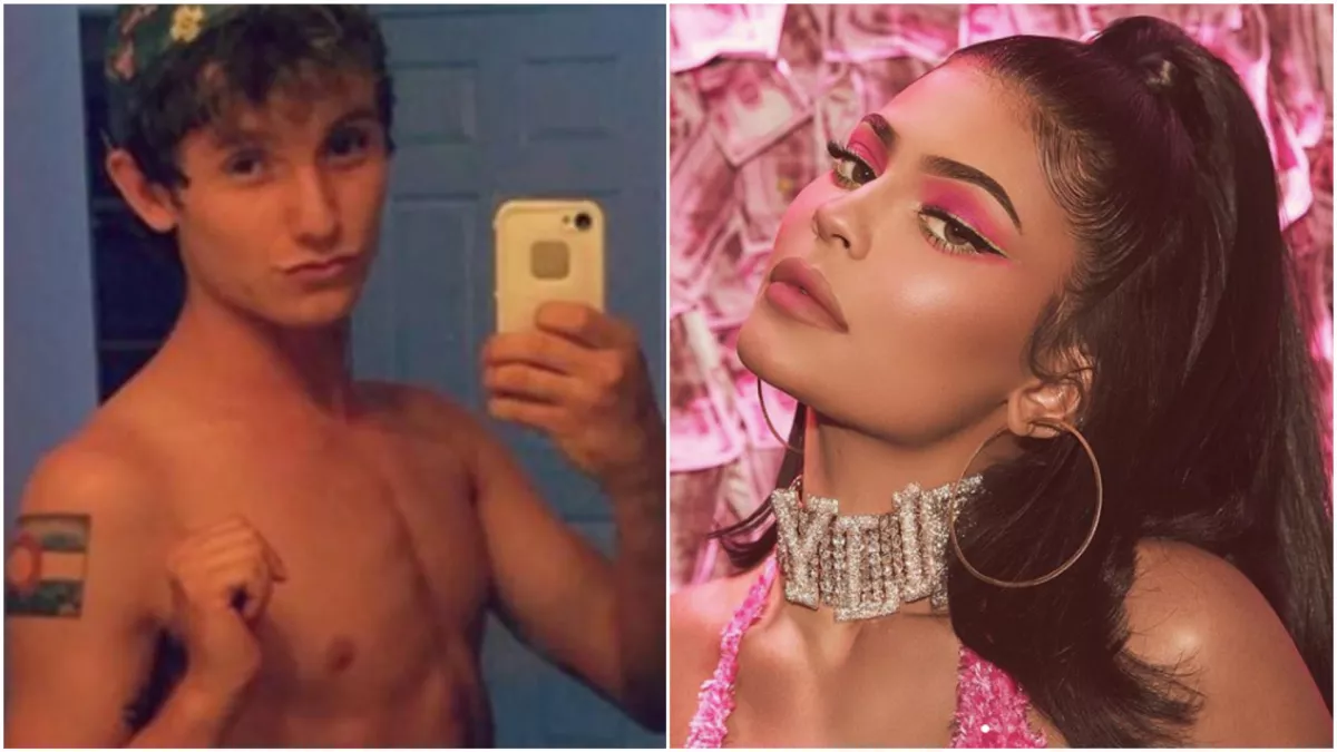 Kylie Jenner-ré műttette magát ez a srác! Valaki egészen más lett - Fotók