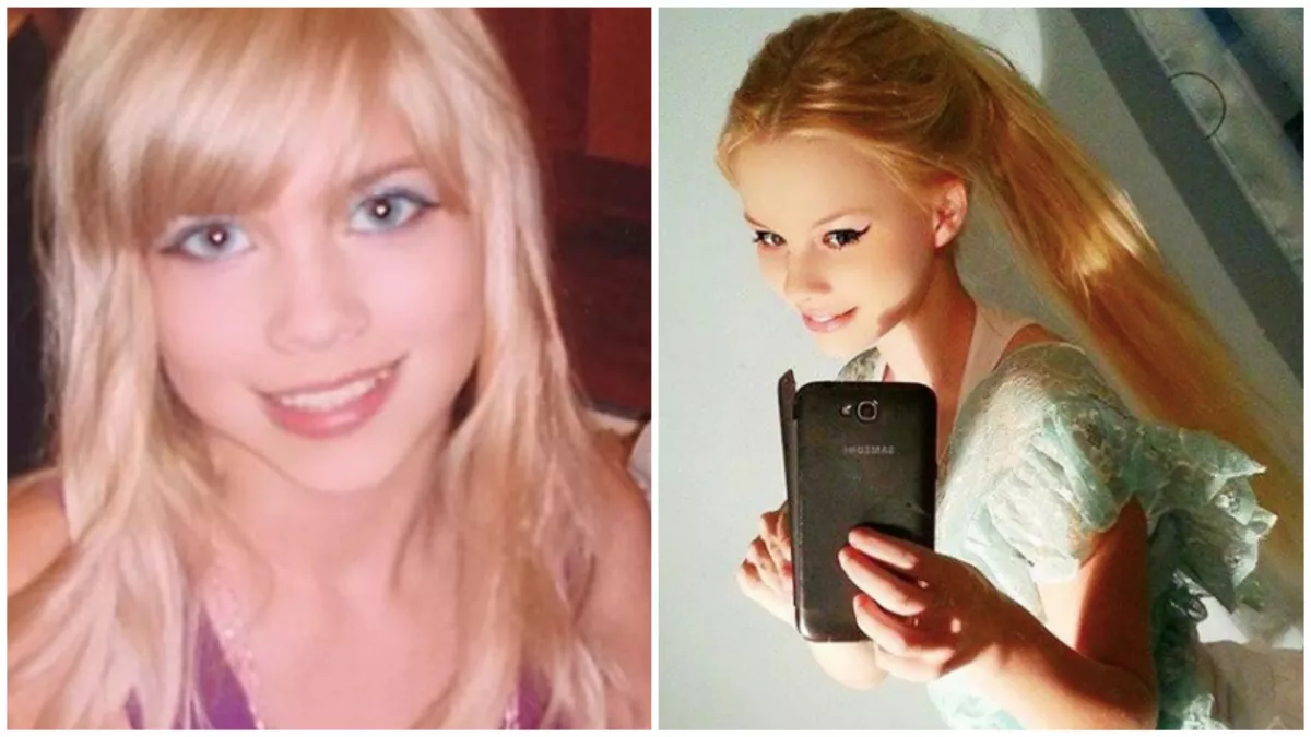 20 éves korára Barbie-szörnnyé operáltatta magát Gabi! Így néz ki ma - Fotók