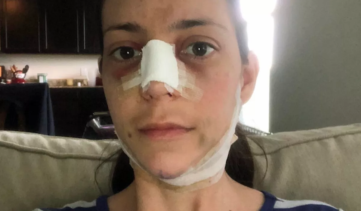 Meghan Markle-t operáltatott magából ez a háromgyerekes anyuka! Így sikerült - Fotók