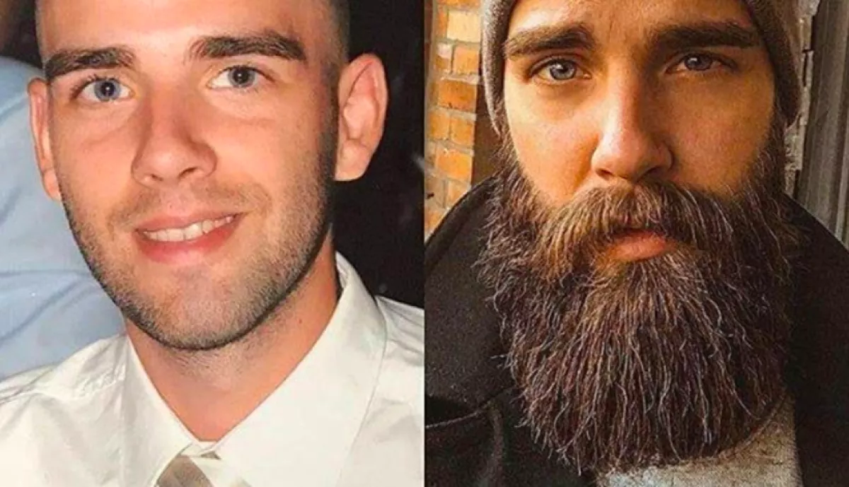 ELŐTTE-UTÁNA: ellenálhatatlanná tette a szakáll ezt a 10 férfit! - Fotók