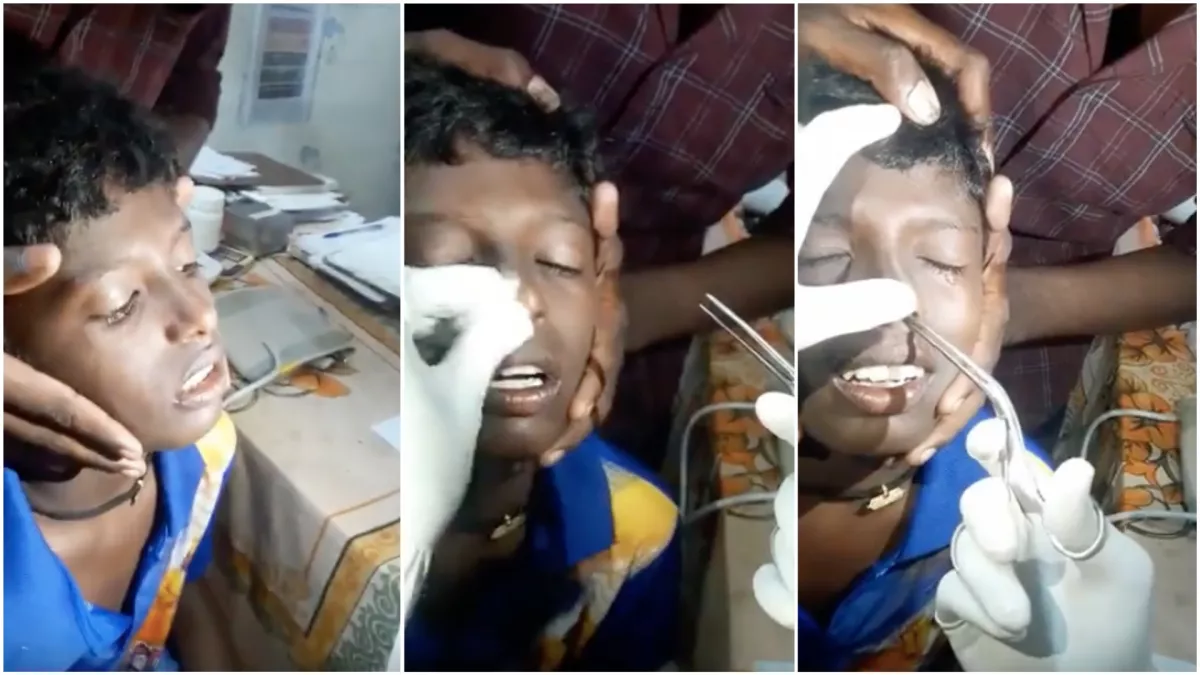 Nem találod ki, mit vett ki az orvos a kisfiú orrából! - Videó