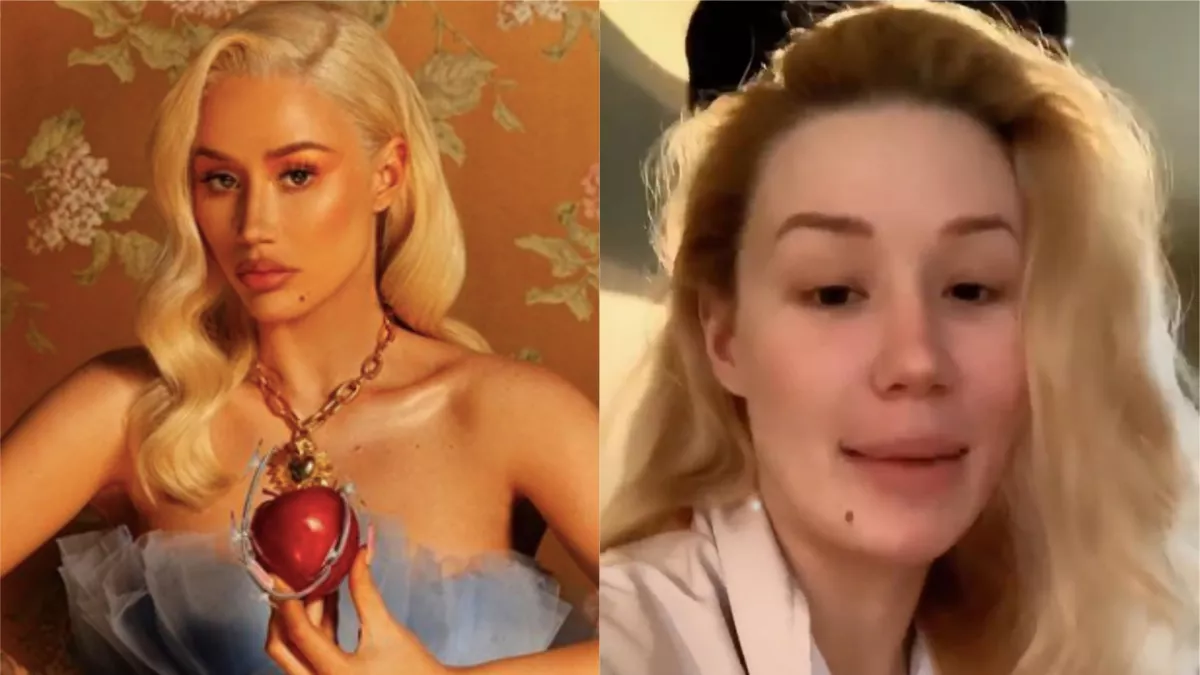 Íme 6 újabb világsztár smink nélkül! Megrázó a valóság - Galéria 