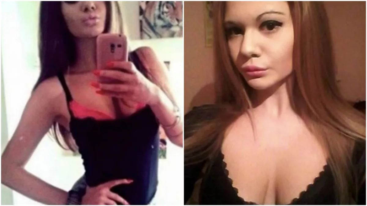 Gyönyörű lány volt Andrea - Plasztikszörnnyé műtötték! - Fotók