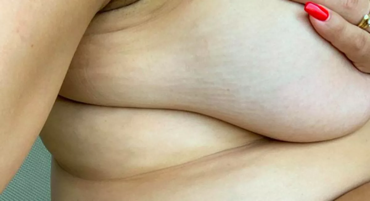 Hős lett! Szülés után mutatta meg a striáit a híres modell - Fotók