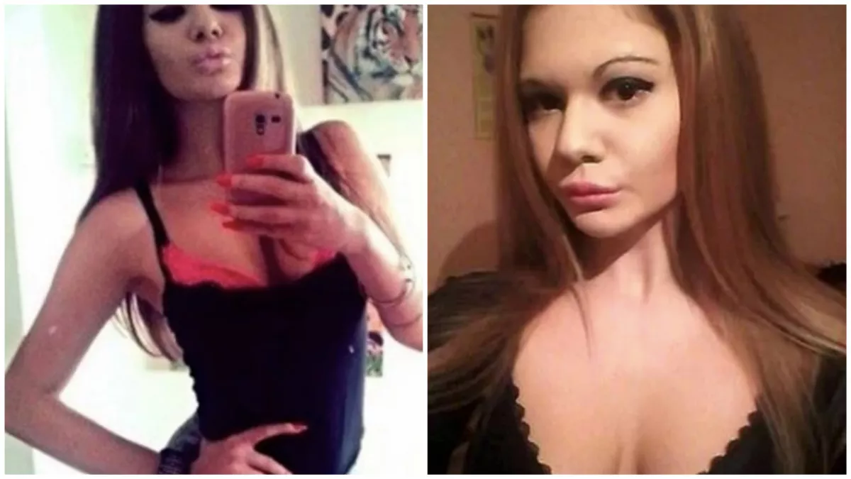 Andreából 22 évesen lett "Balkán Barbie" - 15 műtét kellett hozzá! - Fotók