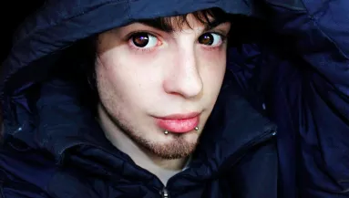 Közel 20 milliót költött ez a srác, hogy manóvá műttesse magát - Fotók