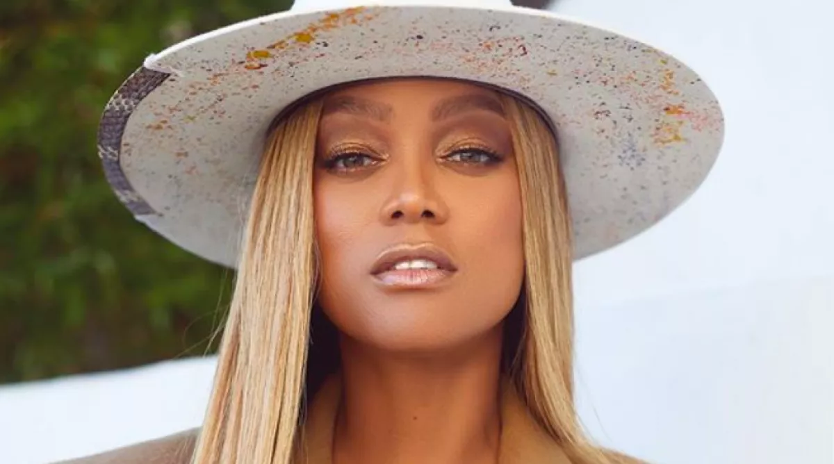 Combos! 14 kilót szedett fel a szupermodell - leleplező fotók készültek!