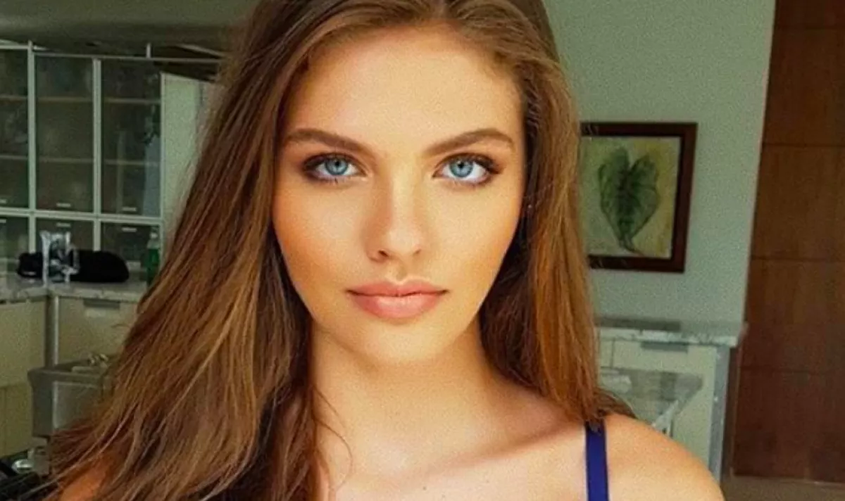 20 kilót hízott, így robbant be a divatvilágba ez a modell! - Fotók