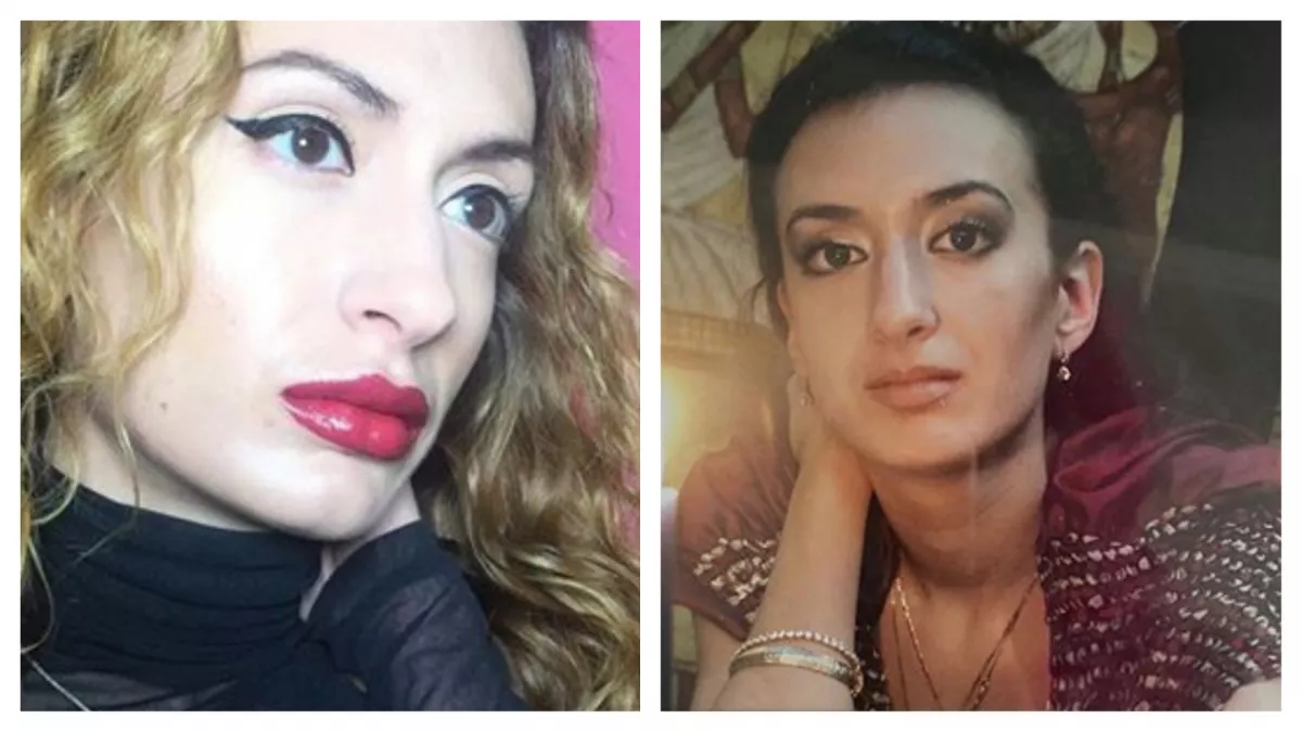 Házilag botoxol, olyan feje lett a modellnek, mint a Michelin-baba teste - Fotók