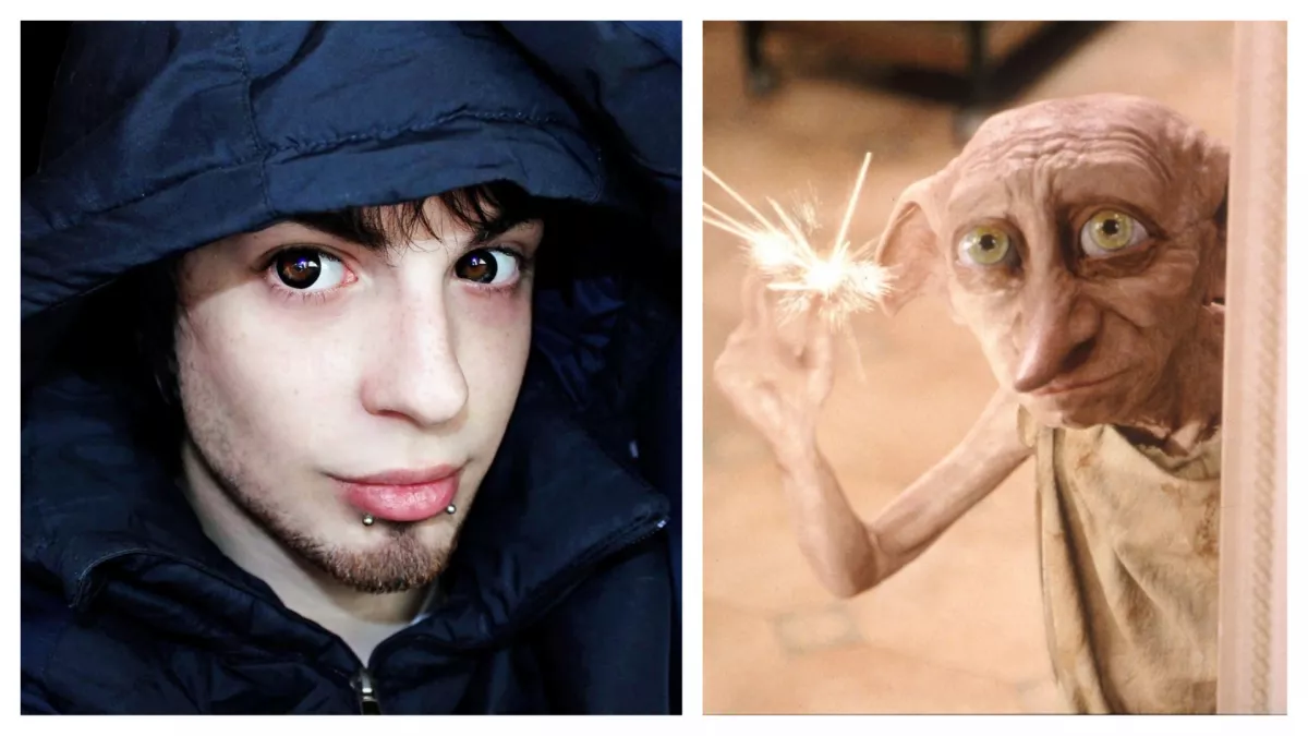 20 milliót költött, hogy manóvá műtsék - így néz ki ma ez a srác! - Fotók