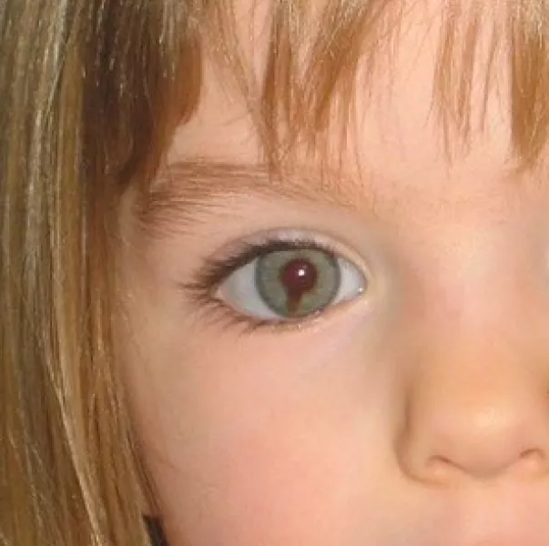 Madeleine McCann egyik ismertetőjegye a jobb szemén látható kolobóma, ami a szivárványhártya egy ritka deformációja: pupillájából sötét csík húzódik a szeme aljáig. Ezen a képen jól látható, a nő is erről ismerte fel.