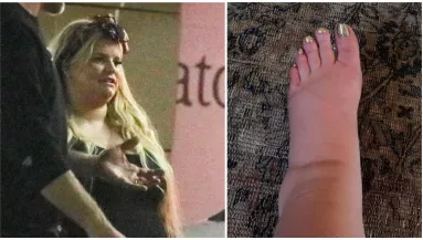 Rá se ismerni: 50 kilót fogyott a terhessége óta az énekesnő! - Fotók