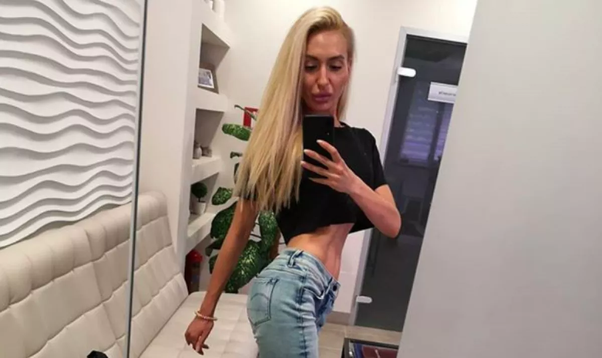 GNÓM: Házilag töltötte fel az arcát Ani, mert nagynak találta az orrát! - Fotók