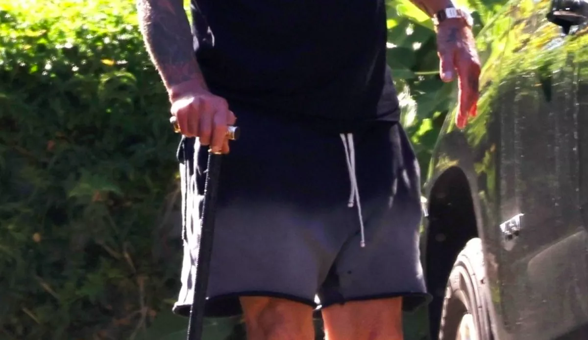 Megdöbbent a világ: bottal, görnyedten csoszog a rocksztár! - Fotó