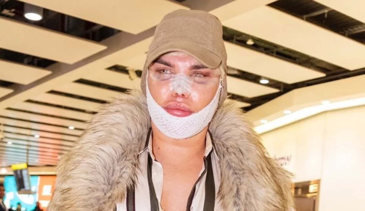 PUSZTÍTÓ: megműtötték, cickányorra lett a néhai Ken babának! - Fotók