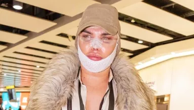 PUSZTÍTÓ: megműtötték, cickányorra lett a néhai Ken babának! - Fotók