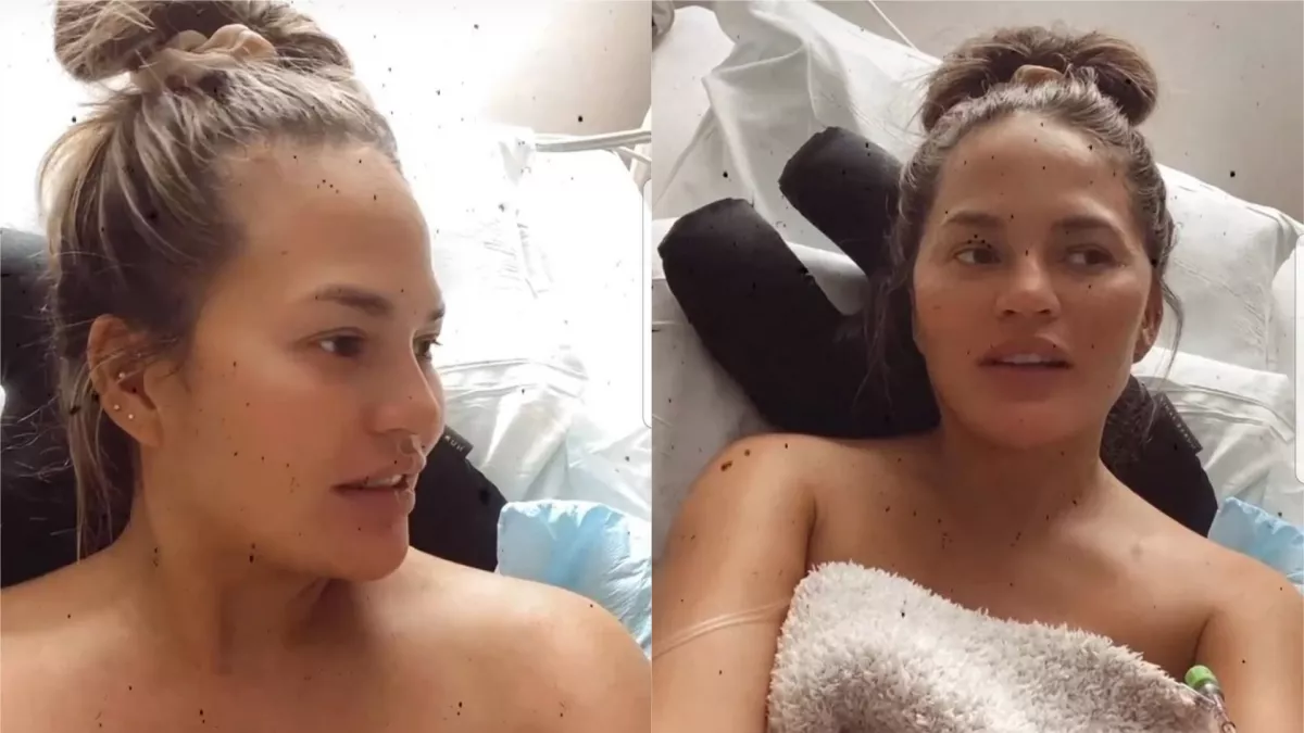 Erős vérzés: kórházba került a várandós Chrissy Teigen - Fotók