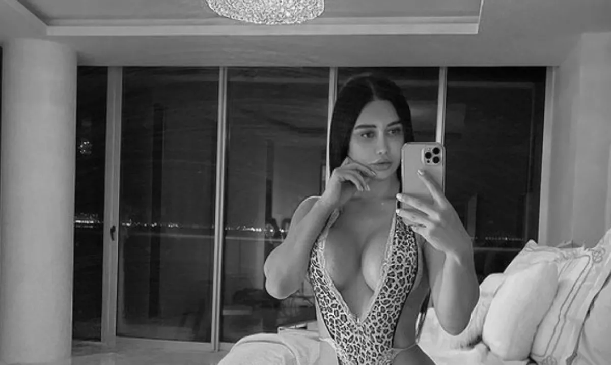 A popsiplasztikába halt bele a szexi influenszer - Sokkolja a világot a temetési videója!