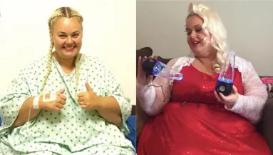 Közel egy mázsát fogyott ez a nő, hogy élő Barbie-vá váljon - Így néz ki most!