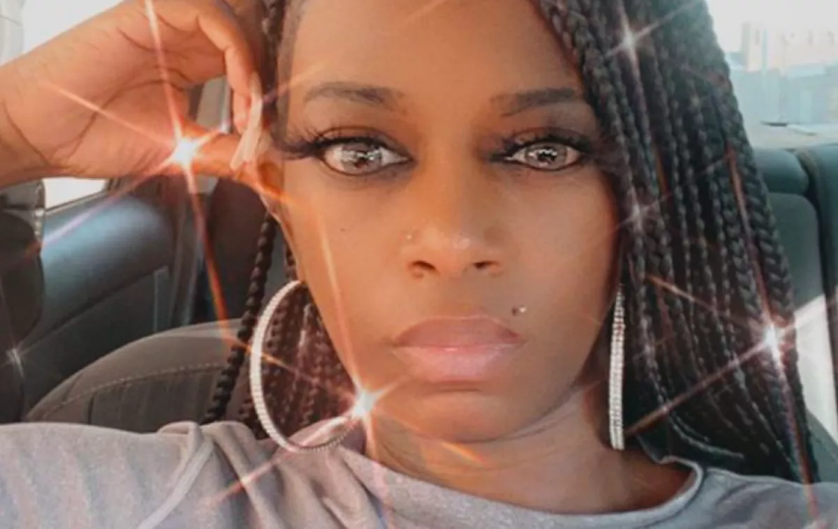 KÓRHÁZ: hajlakk helyett ragasztót nyomott a hajára, így néz ki most az influenszer! - Fotók