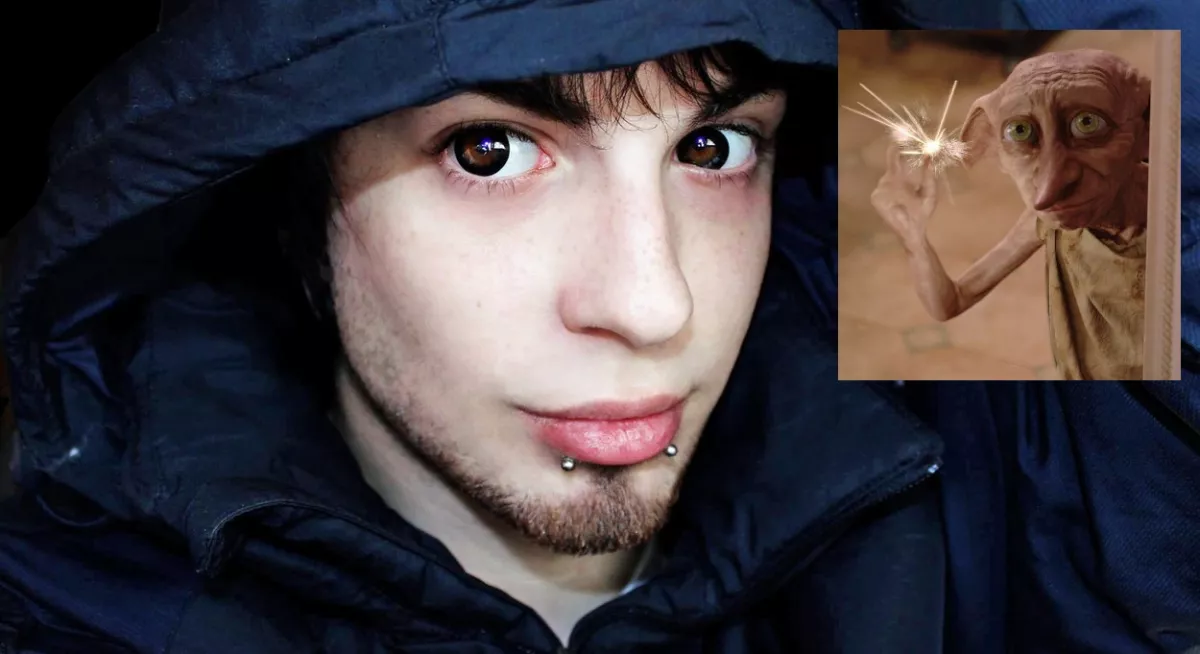 20 millióért műttette manóvá magát ez a srác - női manöken lett végül! - Fotók